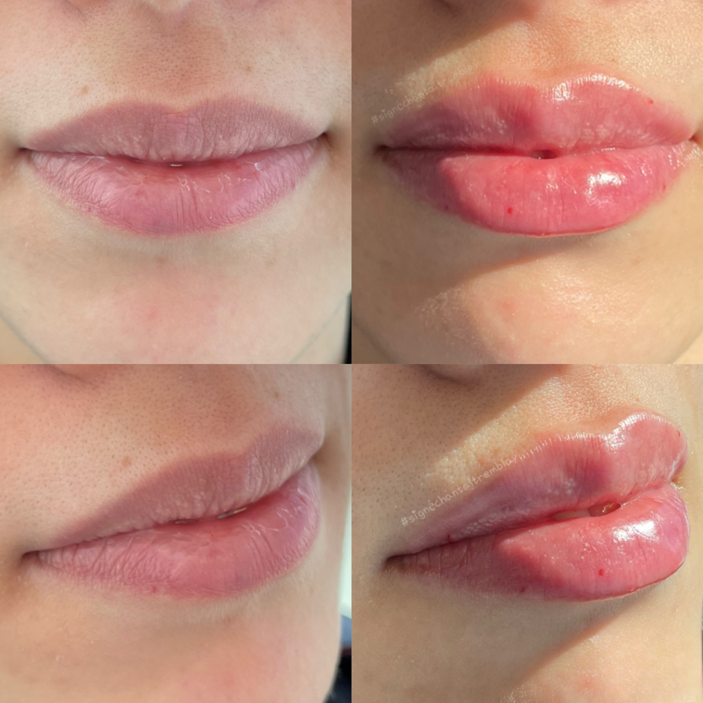Mild Care – Baume à Lèvres Hydratant & Réparateur
