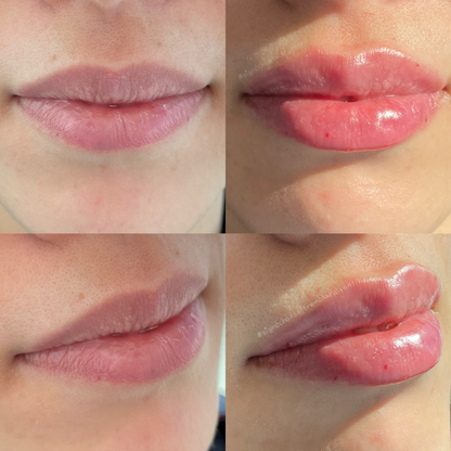 Mild Care – Baume à Lèvres Hydratant & Réparateur